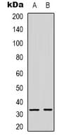 PathPlus™ KLK3 / PSA Antibody (Internal)