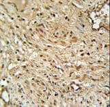 Polyclonal Rabbit anti-Human TWISTNB Antibody (aa298-326, IHC, WB)