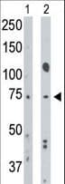 ALK3 / BMPR1A Antibody (aa1-30)
