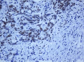 ZSCAN18 / ZNF447 Antibody (clone OTI2A9)