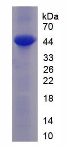 Rat MAPT / Tau Protein (Recombinant His-T7)