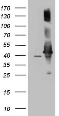 AHSA1 / AHA1 Antibody (aa1-203, clone OTI1D2, Carrier-free)