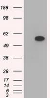 TS / Thromboxane Synthase Antibody (clone OTI1A12)
