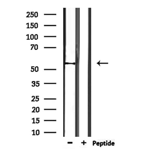 TRMT11 Antibody