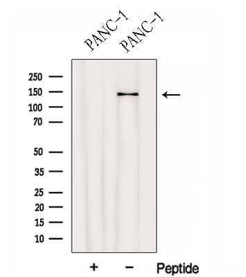 HEPH / Hephaestin Antibody