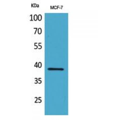 Polyclonal Rabbit anti-Human CER1 Antibody (91-140 aa, Internal, WB)