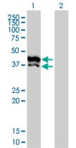GPD2 Antibody (clone 2C11-1F4)