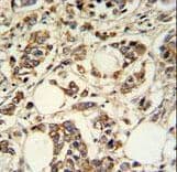 PIGM Antibody (aa394-423)