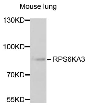 RPS6KA3 / RSK2 Antibody