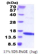 Human IFN Gamma / Interferon Gamma Protein (Recombinant)