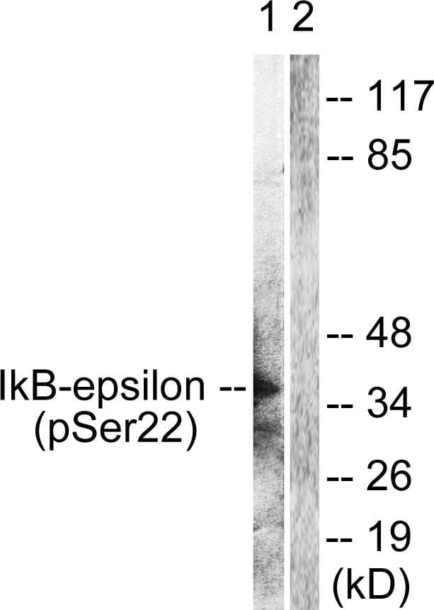 NFKBIE / IKB Epsilon Antibody (phospho-Ser22)