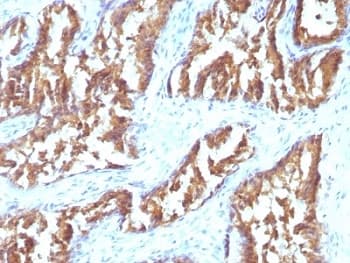 IDH1 / IDH Antibody (aa280-420, clone IDH1/1152)