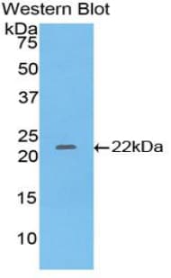 IFN Beta / Interferon Beta Antibody (aa22-186)