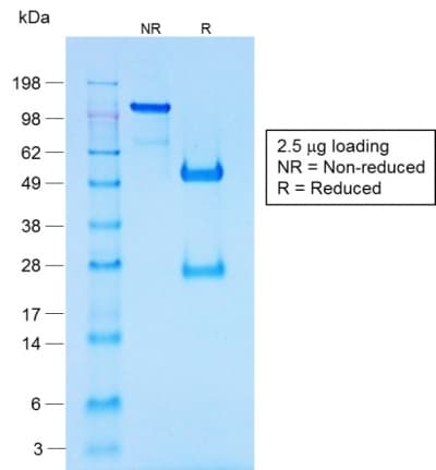 Recombinant Monoclonal Rabbit anti-Human CHGA / Chromogranin A Antibody (clone CHGA/1731R, IHC)