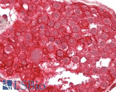 IHC-plus™ Polyclonal Rabbit anti-Human SDCCAG3 Antibody (aa218-435, IHC, WB)