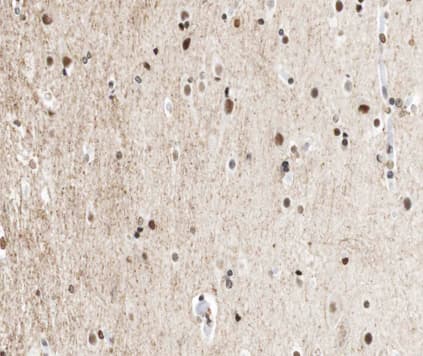 CTBP1 / CTBP Antibody