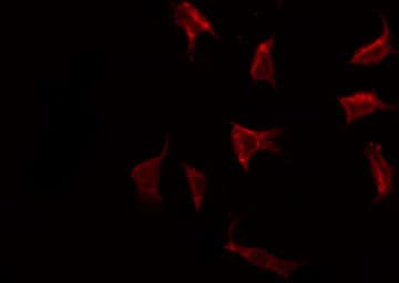 RPS6 / Ribosomal Protein S6 Antibody