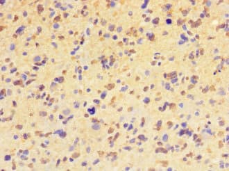 HIST1H2BD Antibody