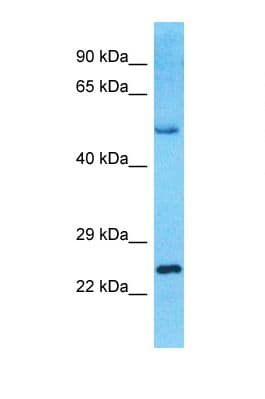 IKZF3 / AIOLOS Antibody (aa181-230)