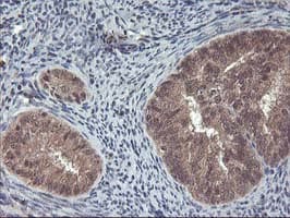FGF21 Antibody (clone OTI2F10)