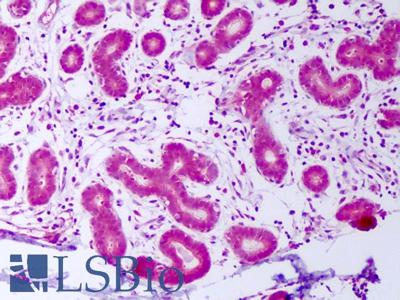 IHC-plus™ Polyclonal Rabbit anti-Human PDGF-AA Antibody (IHC, WB)