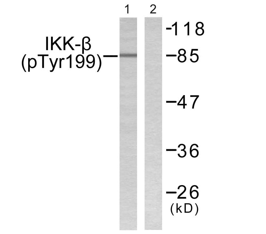IKBKB / IKK2 / IKK Beta Antibody (phospho-Tyr199)