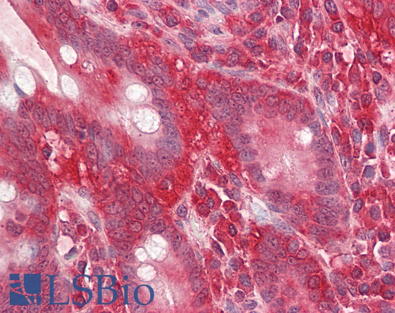 IHC-plus™ GNB2L1 / RACK1 Antibody (aa133-147)