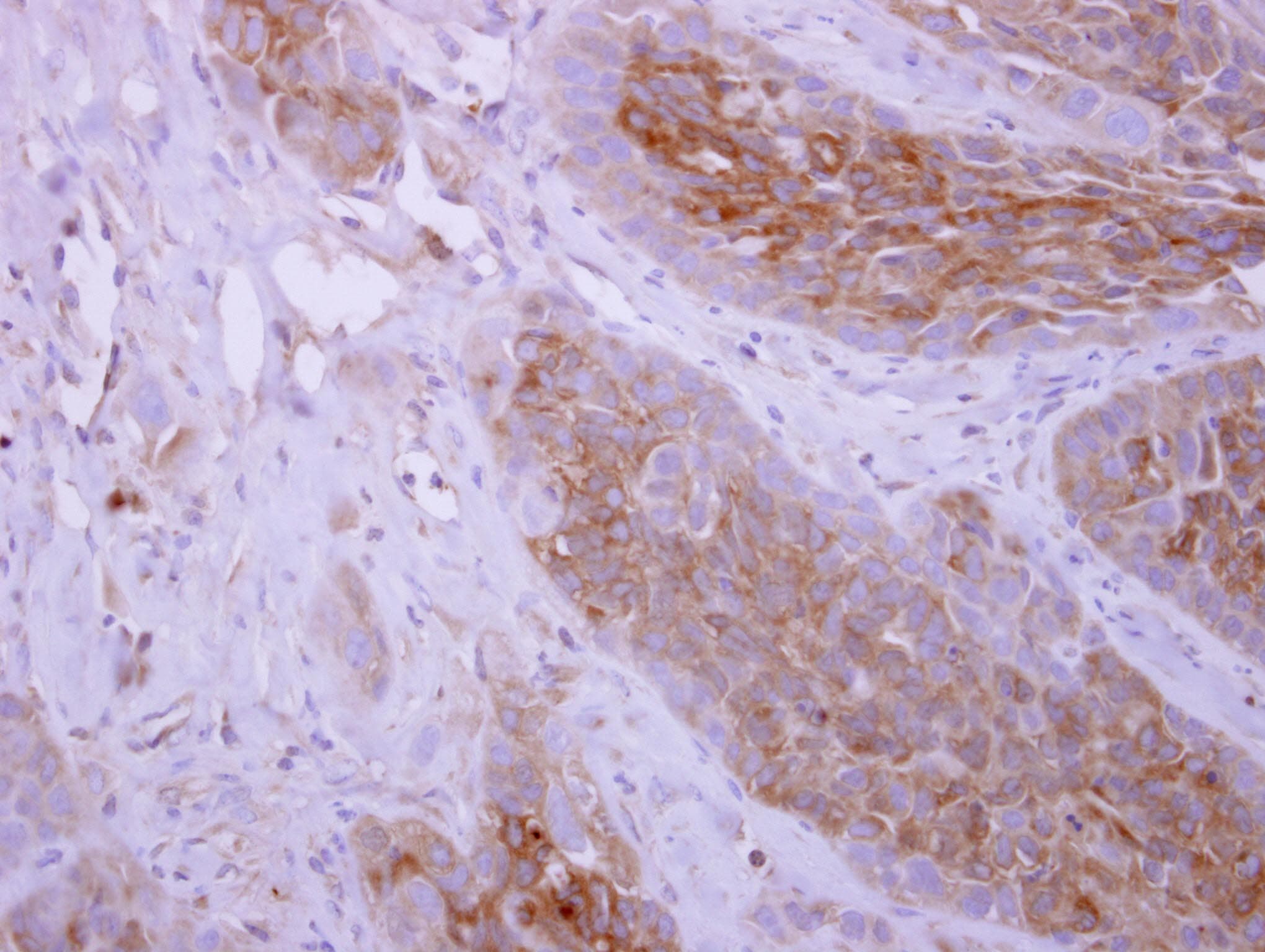 DPYD / DPD Antibody (aa1-174)