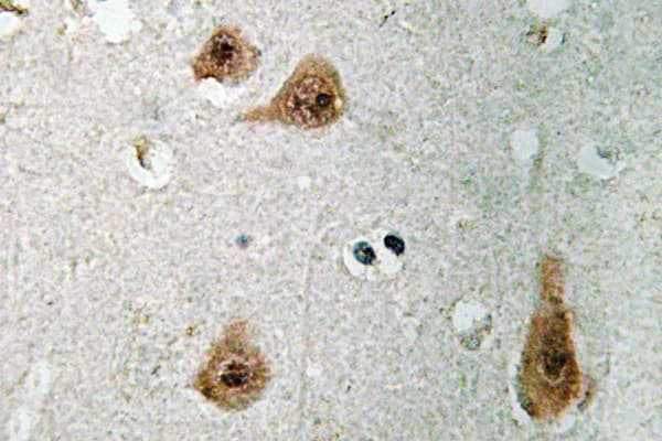 ANXA1 / Annexin A1 Antibody (Asn146)