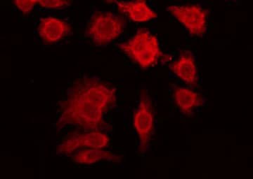 Polyclonal Rabbit anti-Human GPR108 Antibody (IF, WB)