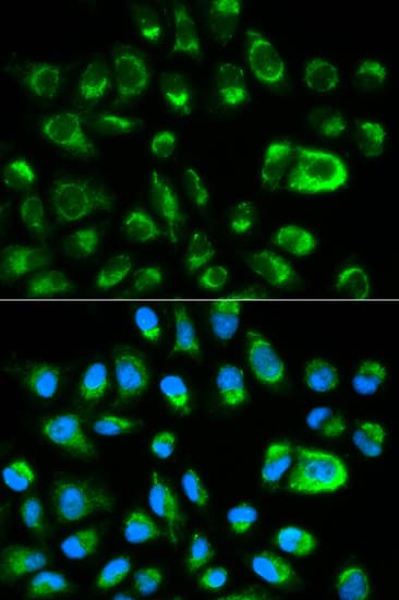 GAS2 Antibody