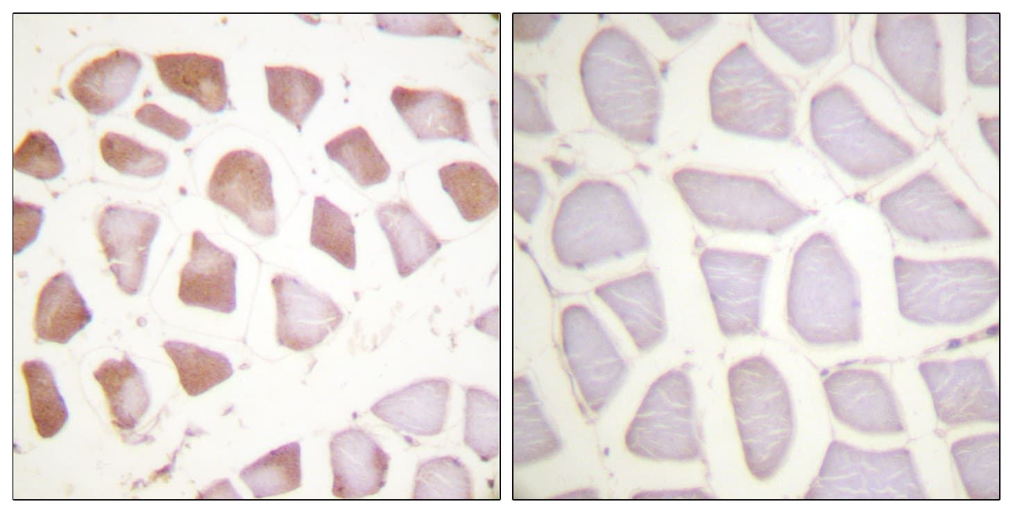 TNNI3 / Cardiac Troponin I Antibody (aa111-160)