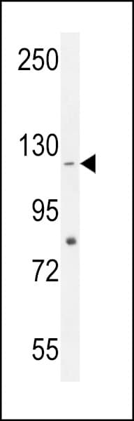 Polyclonal Rabbit anti-Human CCDC15 Antibody (aa688-716, WB)