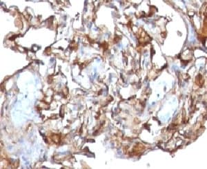 MCAM / CD146 Antibody (clone CDLA146)