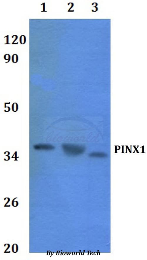 Polyclonal Rabbit anti-Human PINX1 Antibody (WB)