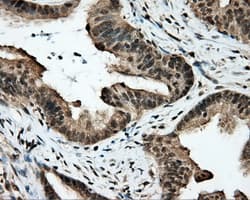 Monoclonal Mouse anti-Human APP / Beta Amyloid Precursor Antibody (clone OTI9E2, IHC, IF, WB)