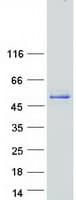 Human CTB / PCYT1B Protein (Recombinant Myc-DDK (Flag))