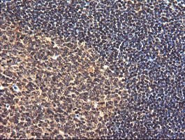 PIK3CG / PI3K Gamma Antibody (clone OTI6D1)