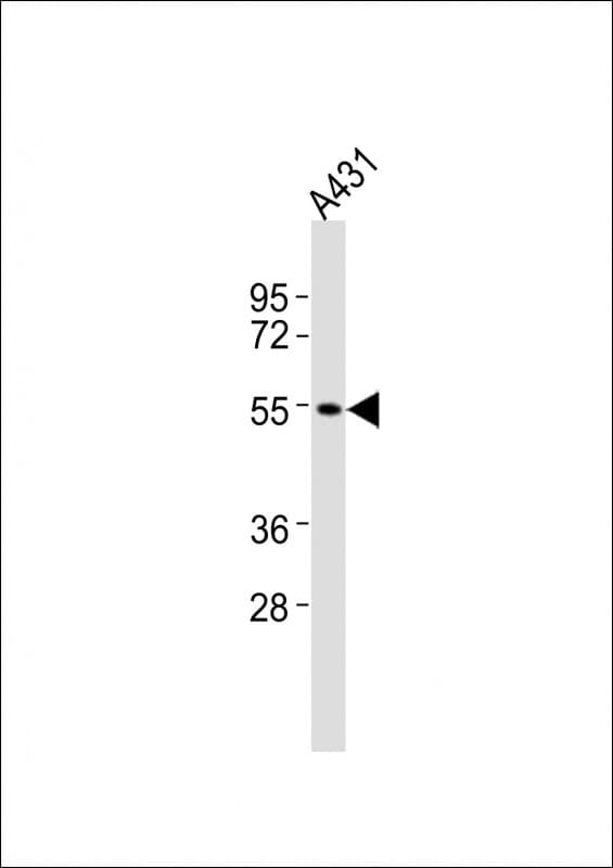 CNR1 / CB1 Antibody (aa433-468)