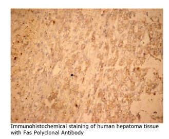 Polyclonal Rabbit anti-Mouse CD95 / FAS Antibody (IHC, WB)