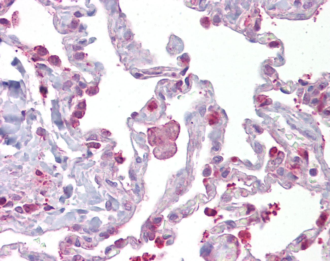 HPGDS Antibody (aa35-84)