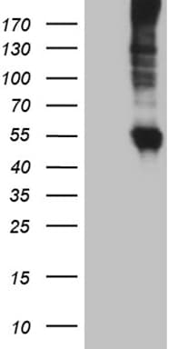 Monoclonal Mouse anti-Human SLC22A17 Antibody (clone OTI2D6, Carrier-free, aa241-300, IHC, WB)