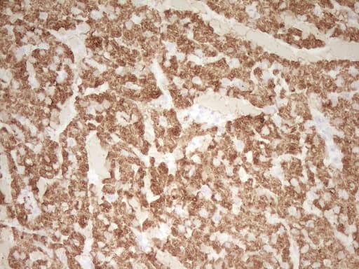 TNNT2 / CTNT Antibody (clone OTI3C6, Carrier-free)