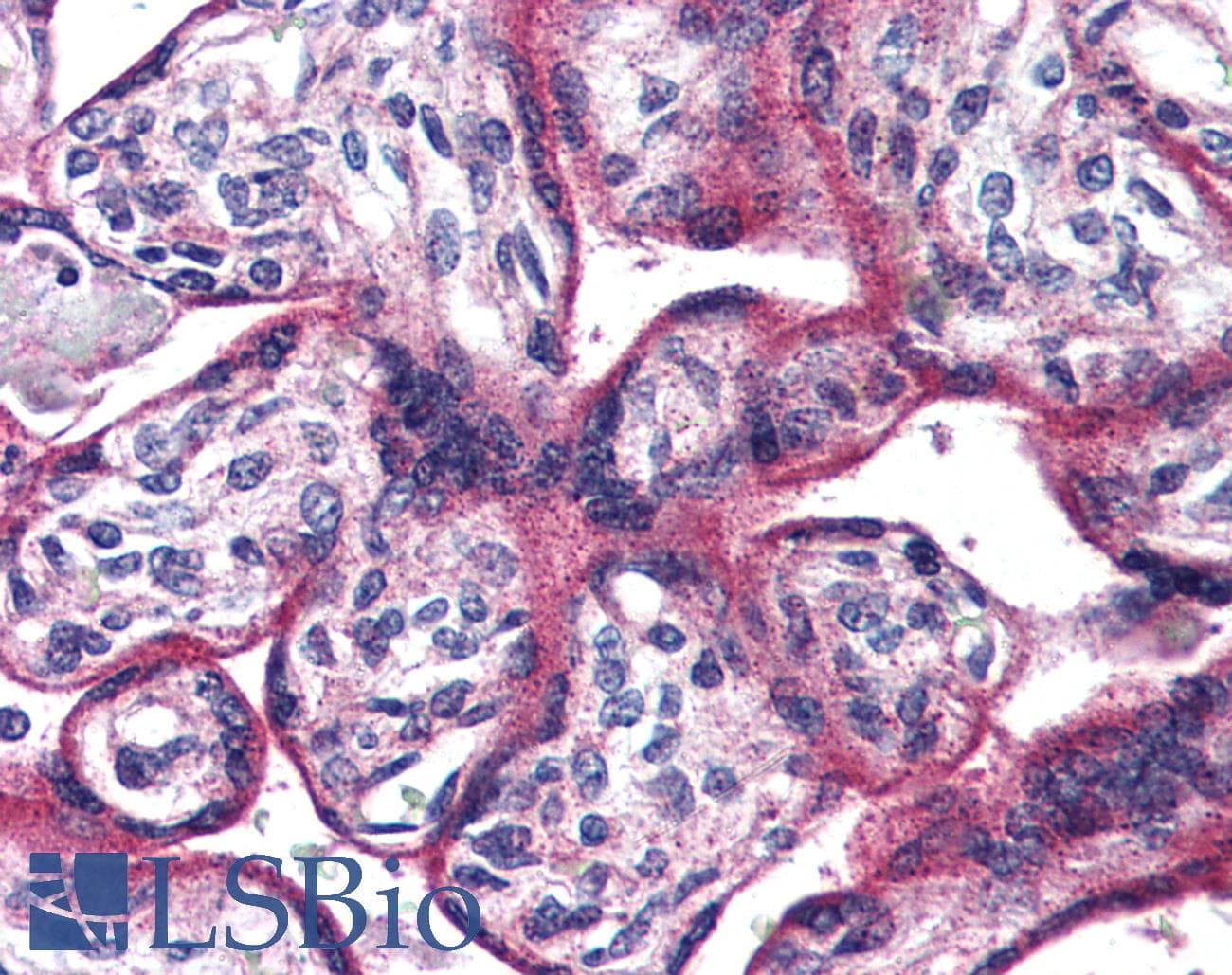 IHC-plus™ Polyclonal Rabbit anti-Human ADCYAP1R1 / PAC1 Receptor Antibody (N-Terminus, IHC)