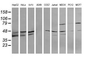 MAP2K3 / MEK3 / MKK3 Antibody (clone OTI2D7)