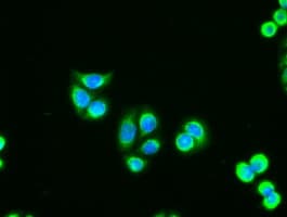 Monoclonal Mouse anti-Human AK1 / Adenylate Kinase 1 Antibody (clone OTI4A1, IF, WB)
