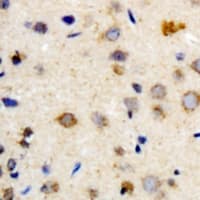 Polyclonal Rabbit anti-Human MYBBP1A Antibody (IHC, WB)