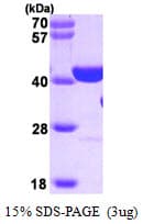 Human PARP1 Protein (Recombinant)
