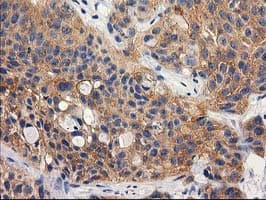 RTN4IP1 / NIMP Antibody (clone OTI3B2)