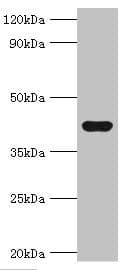IHC-plus™ SEPP1 / Selenoprotein P Antibody